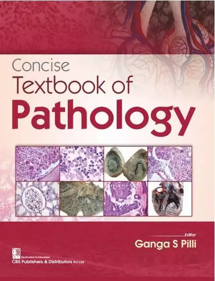 Concise Textbook of Pathology || Pathology Book for 2nd year MBBS