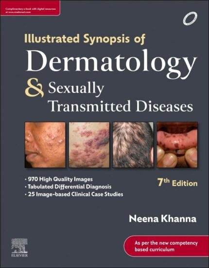 Neena Khanna Dermatology Latest Edition 7th Edition