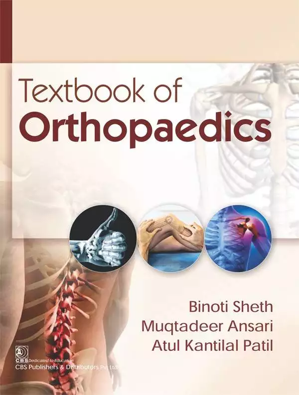 Textbook of Orthopedics for MBBS || MBBS 4th Year Orthopedics Book